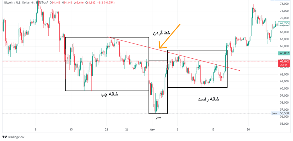 در الگوی سر و شانه خط گردن میتواند اریب باشد